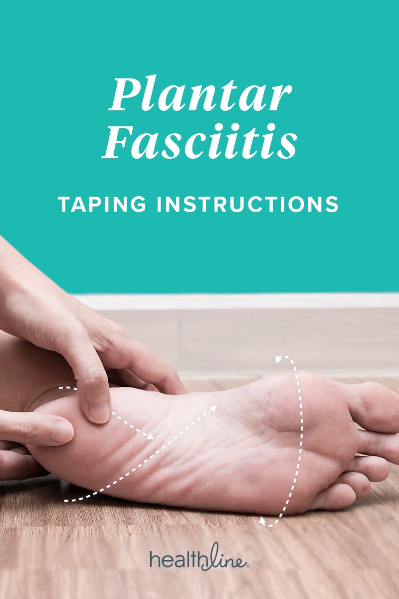 good feet plantar fasciitis