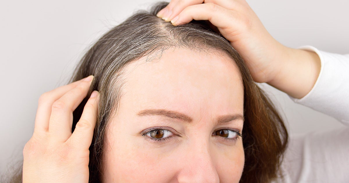 Mole on Scalp: Types of Moles, Risks, and Warning Signs of ...