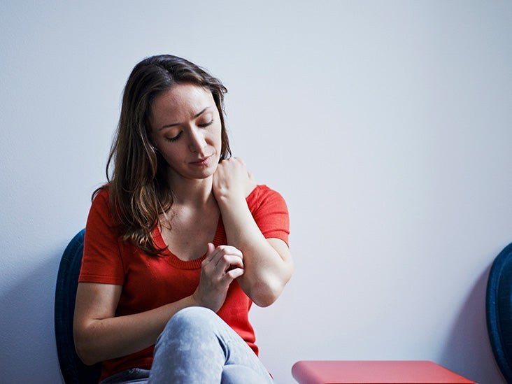 Itchy Scar Causes, Treatments, and Prevention