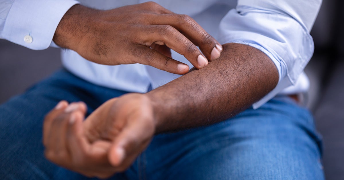 Download Skin Symptoms Of Liver Disease Pics