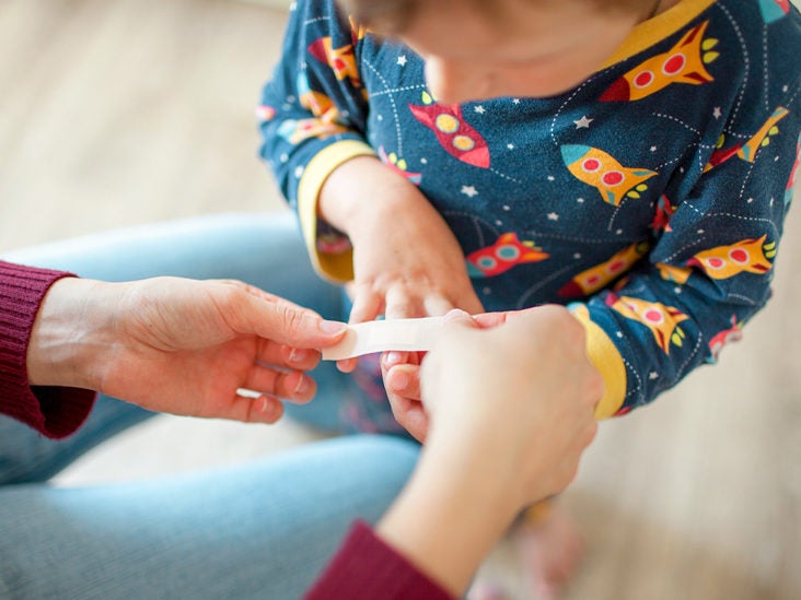 Allergic To Band Aids And Other Bandages Treatment And Alternatives