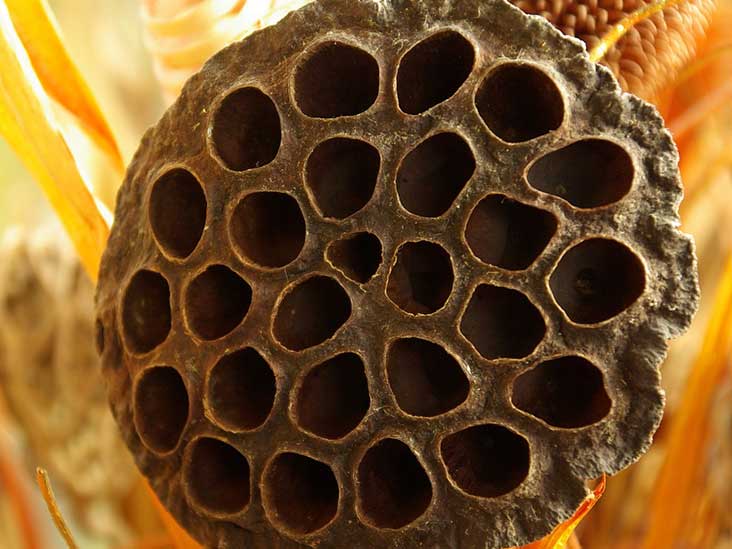 trypophobia-is-it-real-and-what-are-the-triggers