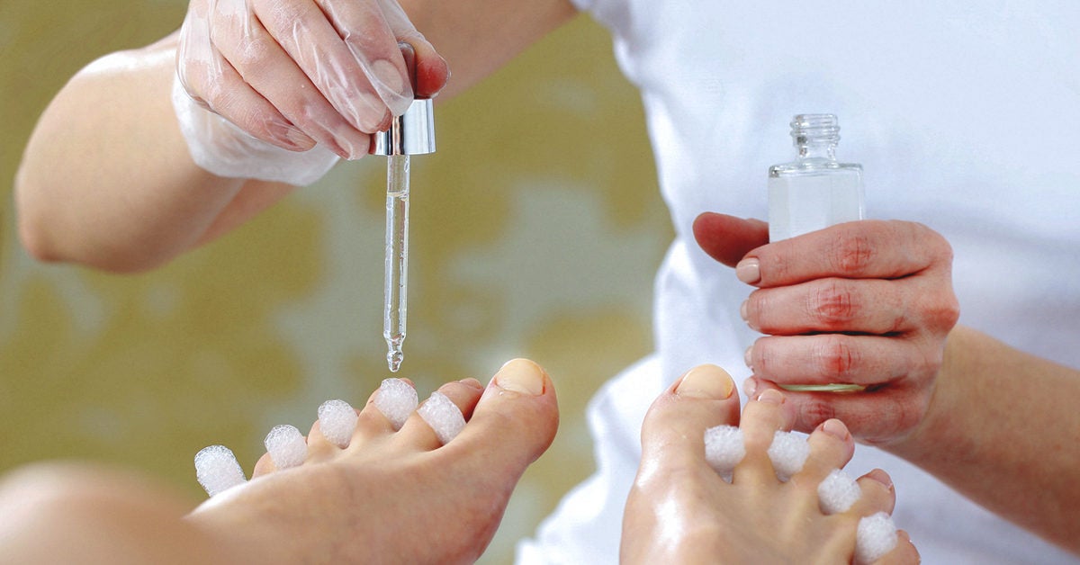 8. Antifungal Nail Polish for Toenail Fungus - wide 4