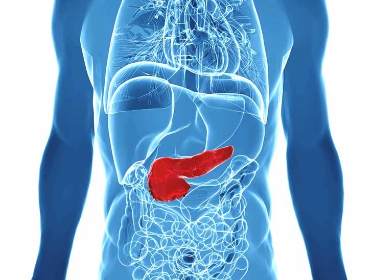 pancreatic cancer what to expect
