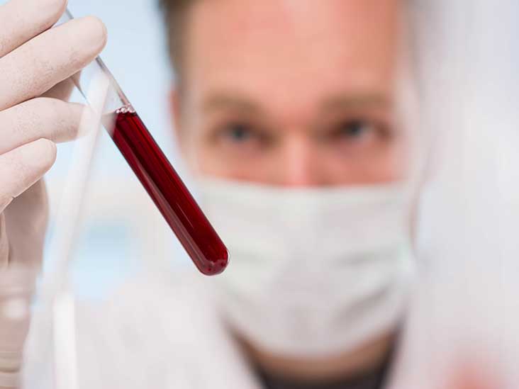 Lyme Disease Antibody Test: Purpose, Procedure, and Risks