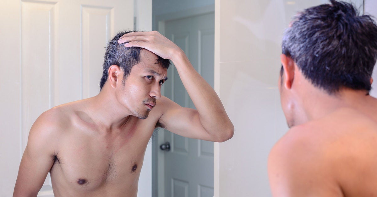 Hair Loss on Temples: Causes and Treatment
