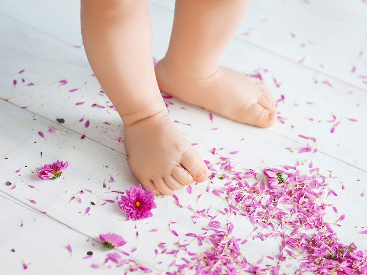 Bowlegs (Congenital Genu Varum) Causes and Treatment