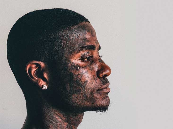 Dermal Piercing: Pictures, Placement 