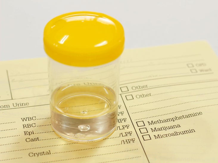 urine-diagnostics-in-hyponatremia-swissnephro