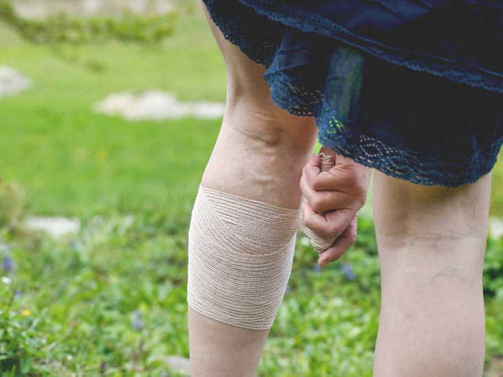 Heavy Legs: Causes, Risk Factors, Relief