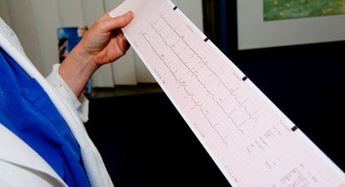 Abnormal Ekg What It Means And Treatment Options