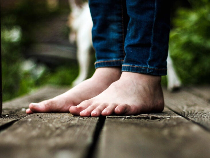 Burning in Feet: 15 Causes, Home 
