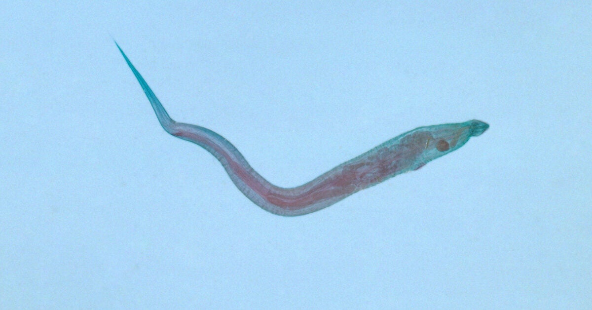 pinworm-infection-symptoms-diagnosis-and-prevention