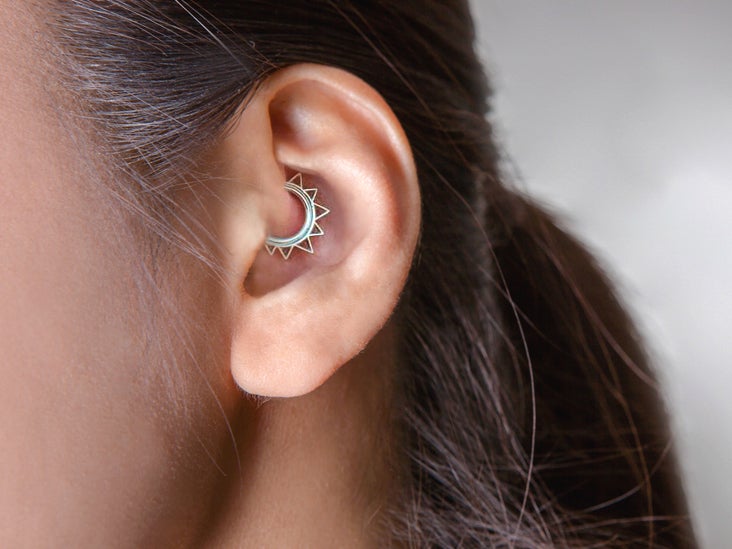 Daith Piercing for Anxiety: Potential 