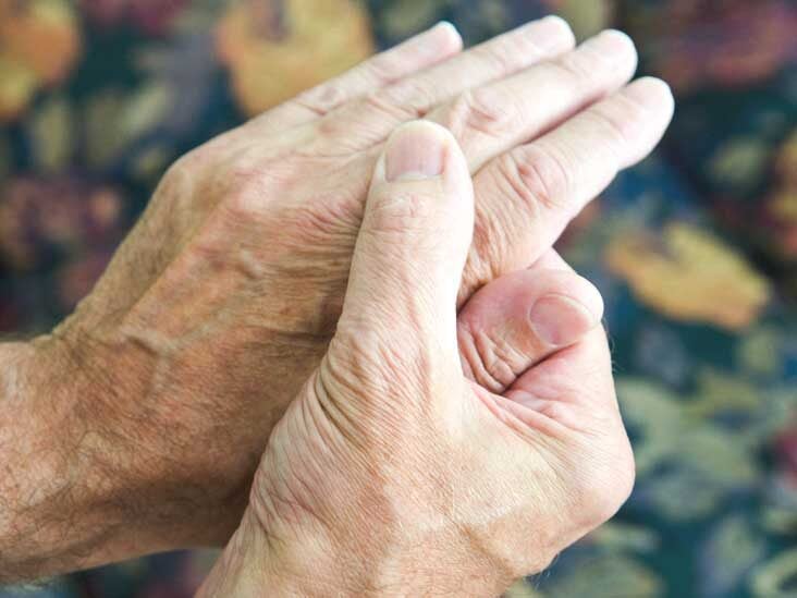 Arthritis: Causes, Signs, and Diagnosis