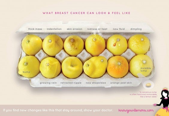 Signs of Breast Cancer