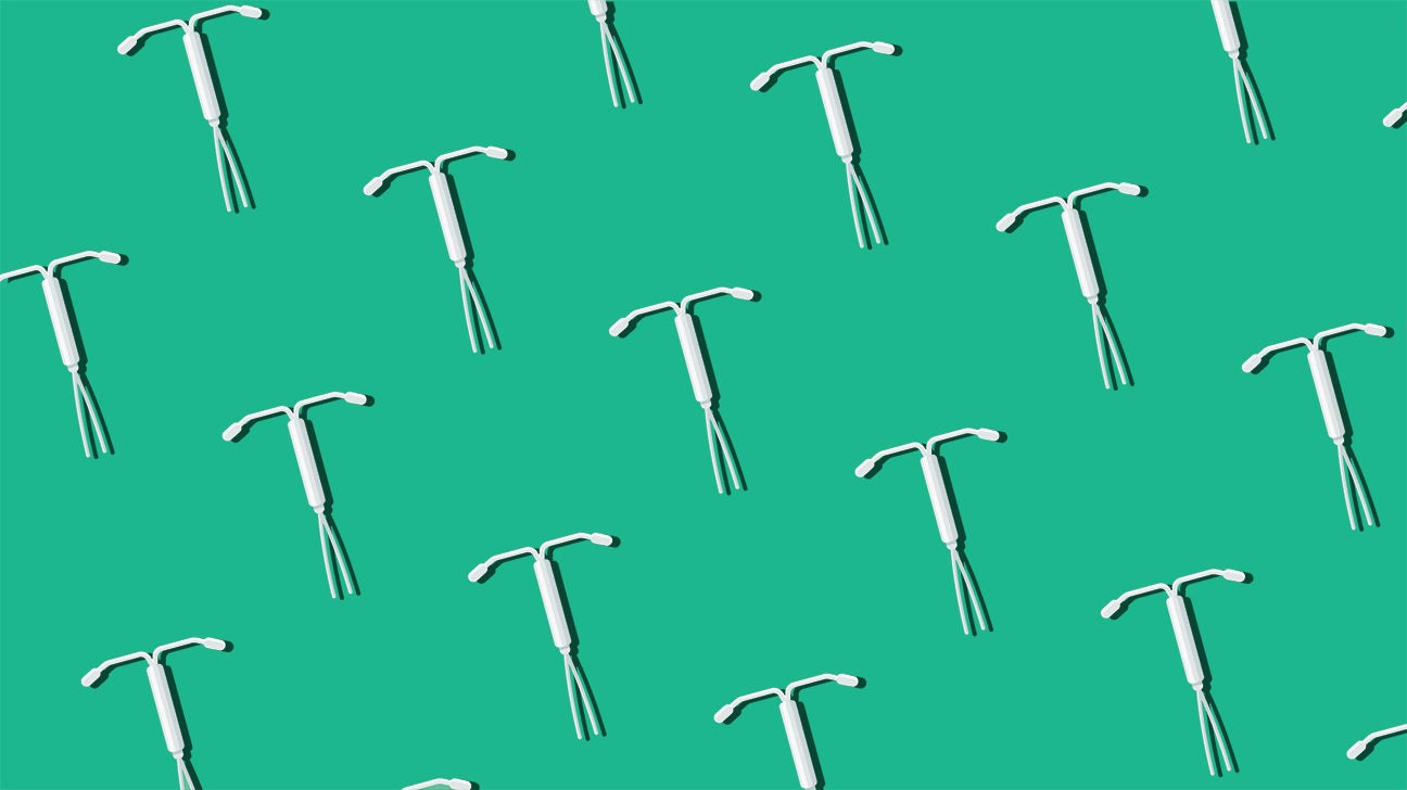 IUD Period Everything You Need to Know