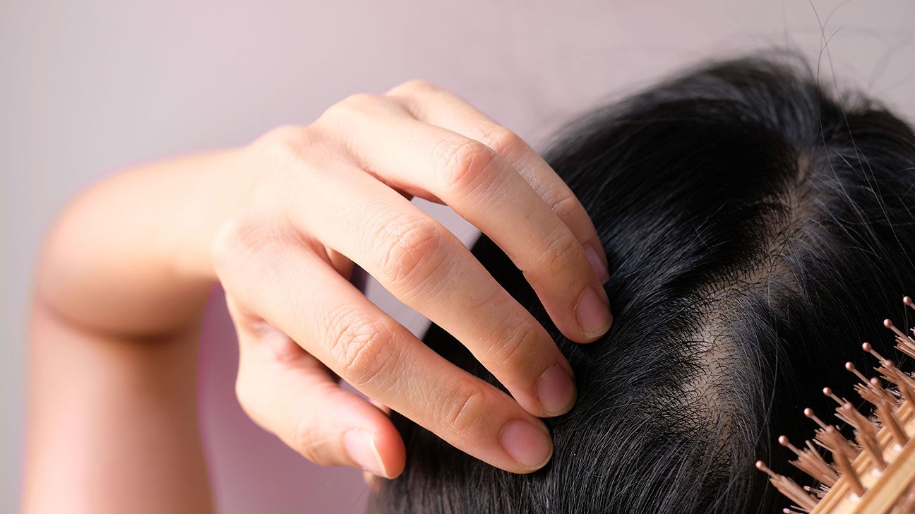 Hair Loss In Women: 14 Treatments For Females