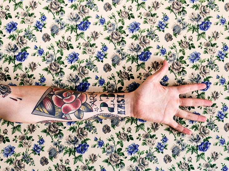 Itchy Tattoo 9 Causes Treatments Risks and More