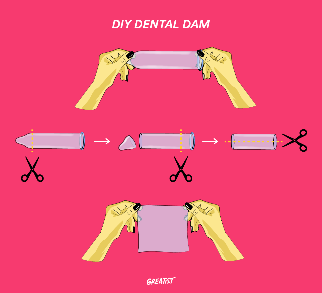 Dental Dam When And How To Use One