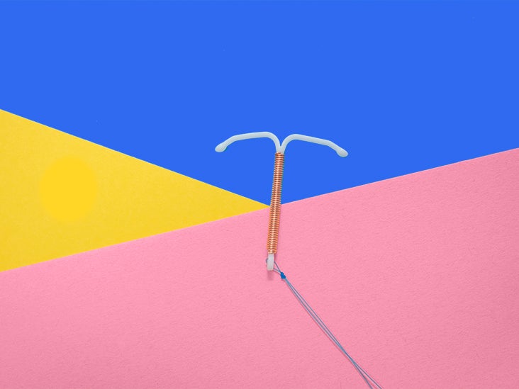 paragard and acne