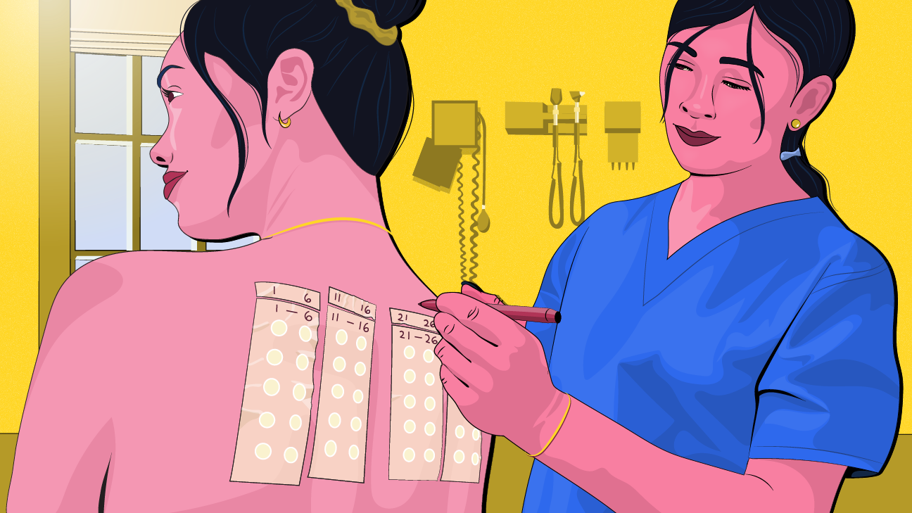 Patch Test How to Identify Allergies and SkinSafe Products