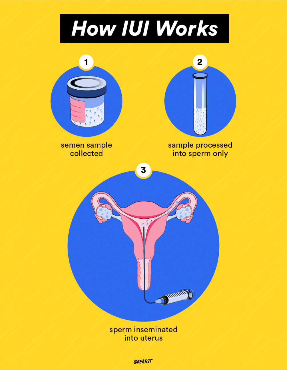 Сперма — 9 удивительных фактов