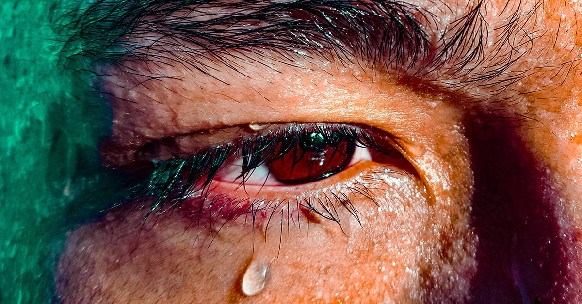 why-do-my-eyes-burn-when-i-cry-causes-and-treatments