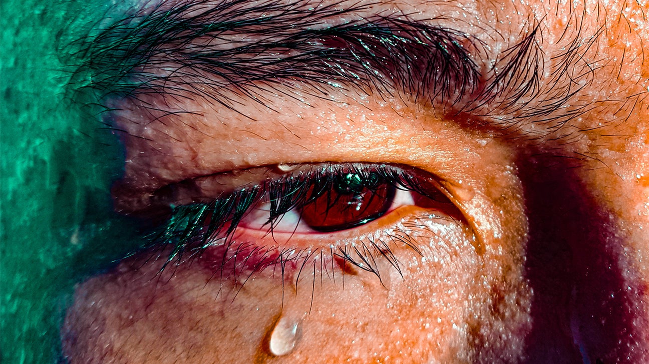 Why Do My Eyes Burn When I Cry: Causes And Treatments