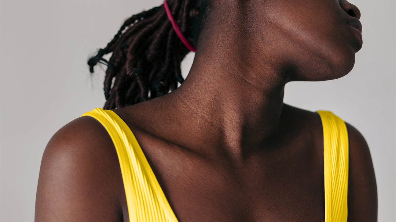 stretch marks on neck