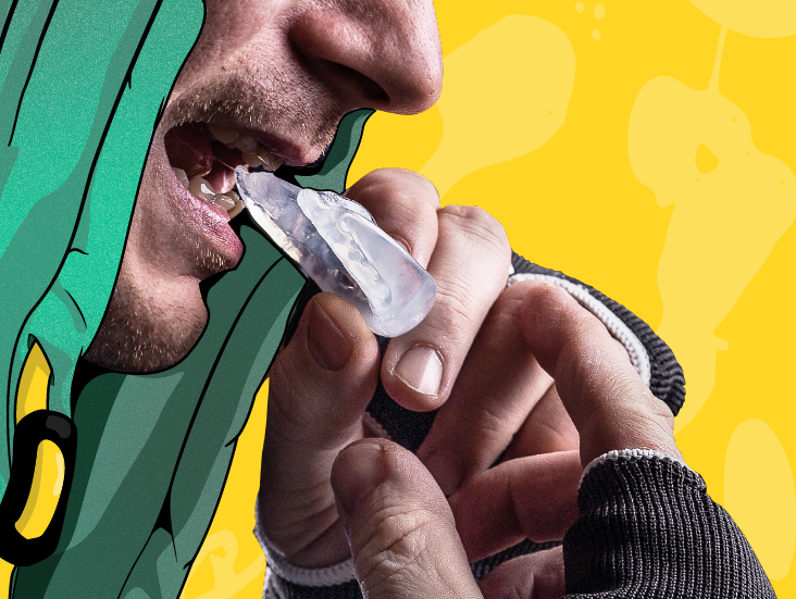 Why You Should Wear a Mouthguard While Weight Training