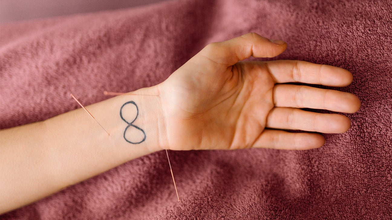 person getting acupuncture on wrist