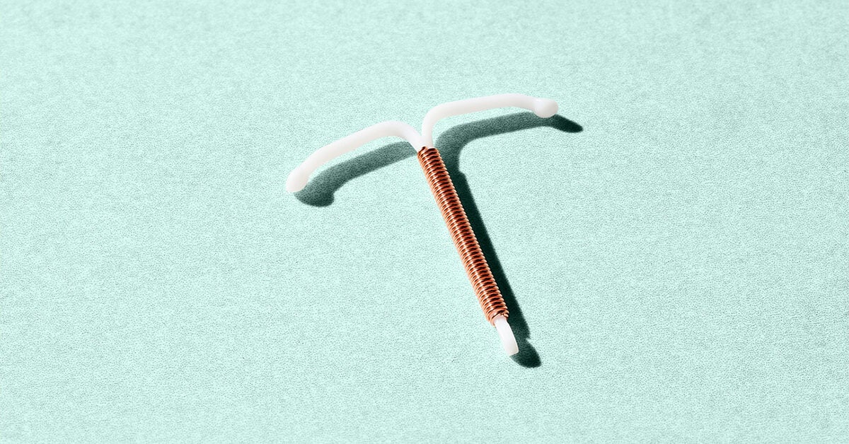 What You Need to Know About IUD Costs