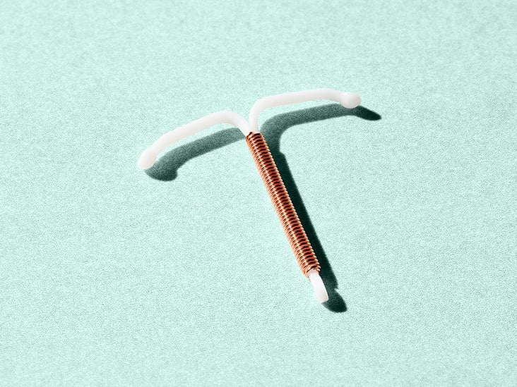 What You Need to Know About IUD Costs