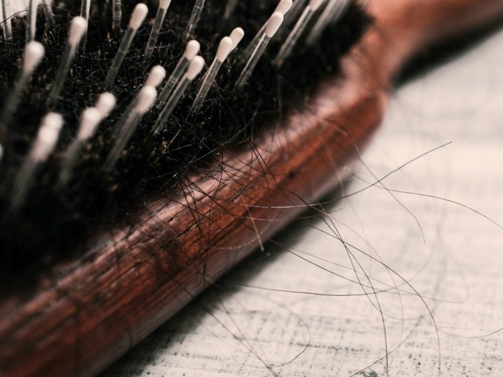 Hair Loss On Temples Causes And What To Do
