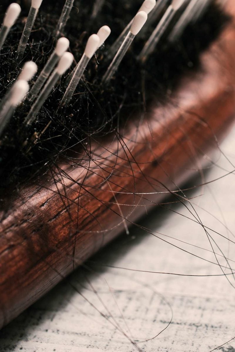 Why Is My Hair Falling Out 10 Causes Of Hair Loss