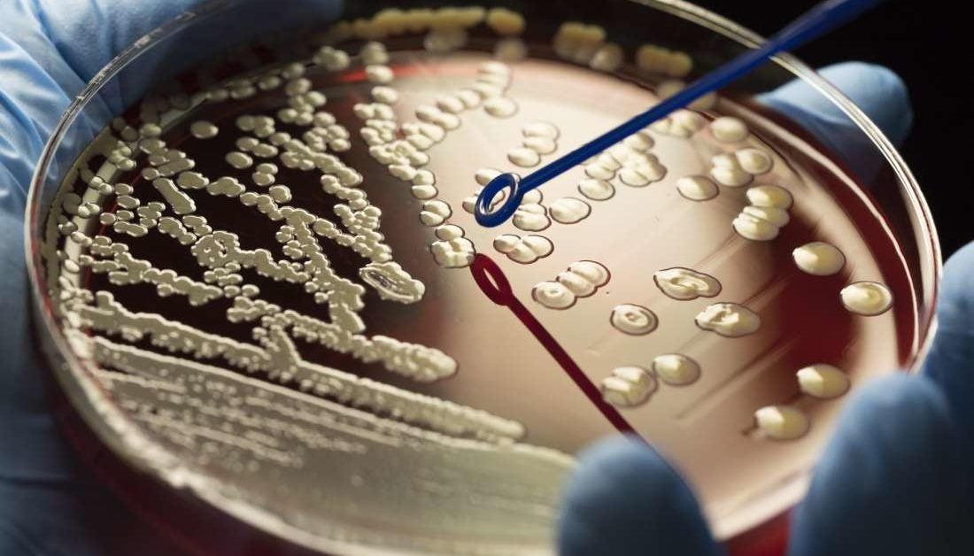 Fosamax Side Effects Femur Fractures Fda  Lawsuit