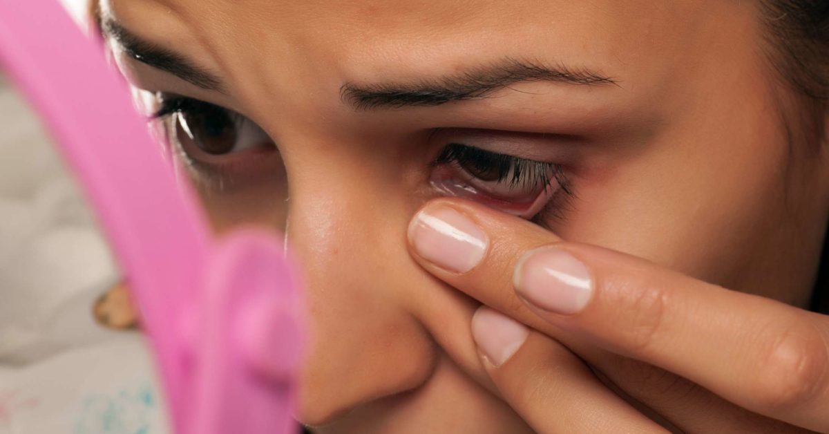 Skin tags on eyelids: Causes and how to remove them