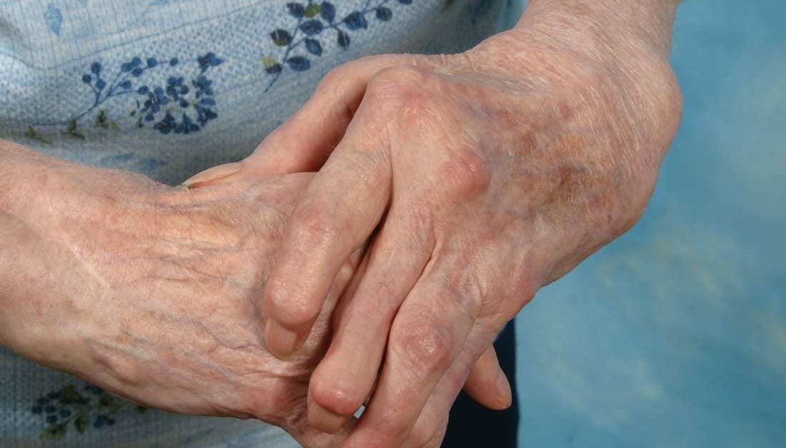 como quitar el dolor de los tendones de la mano