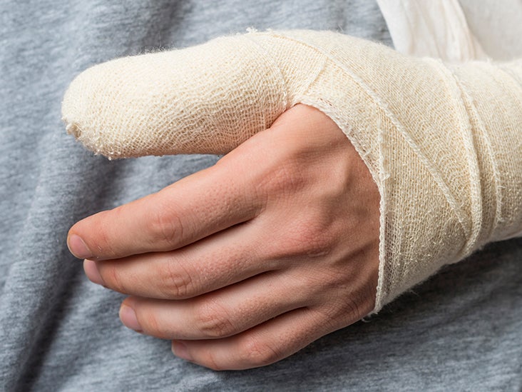 broken-thumb-signs-symptoms-and-treatment