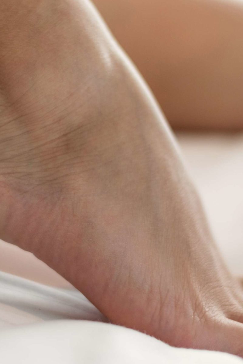 Heel pain: Causes, prevention, and 