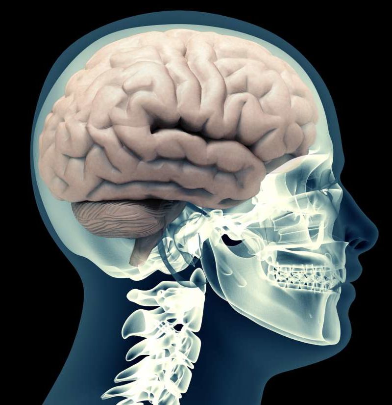 intracerebral-hemorrhage-symptoms-risk-factors-and-treatment