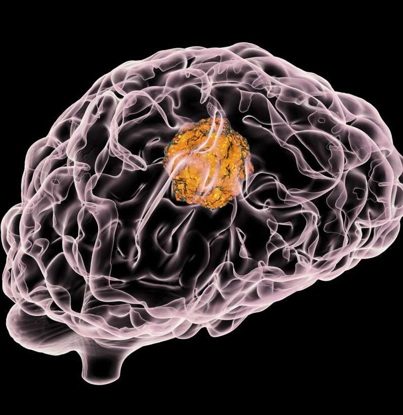 Electric field therapy boosts survival from deadly brain tumor