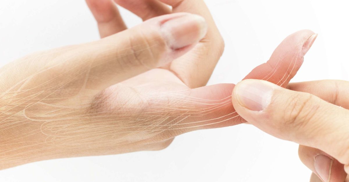 Sprained finger Symptoms, treatment, and recovery