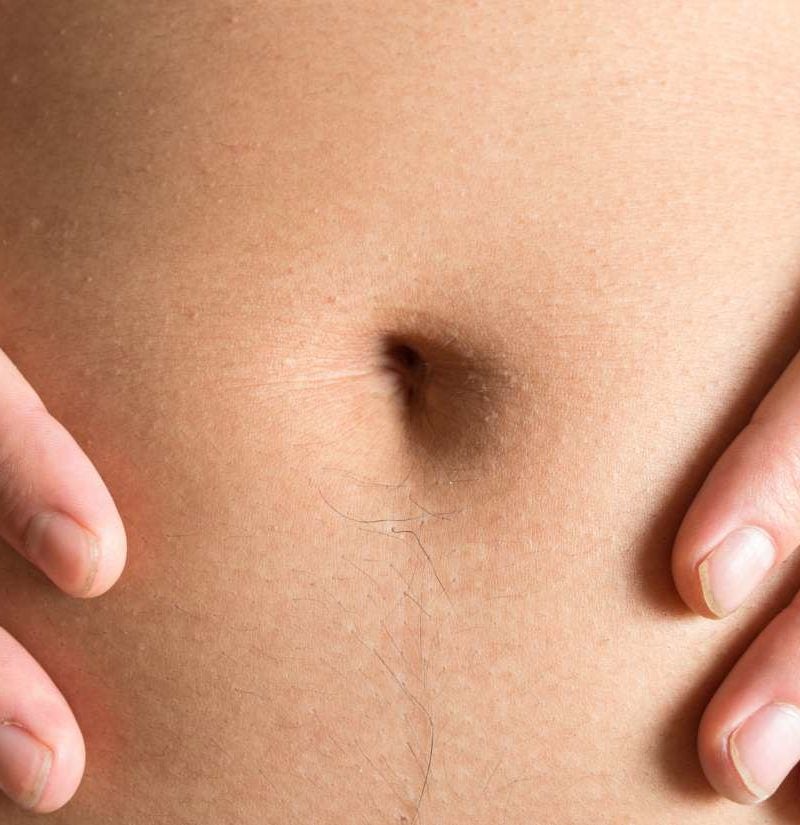 Why does my belly button smell? Causes 