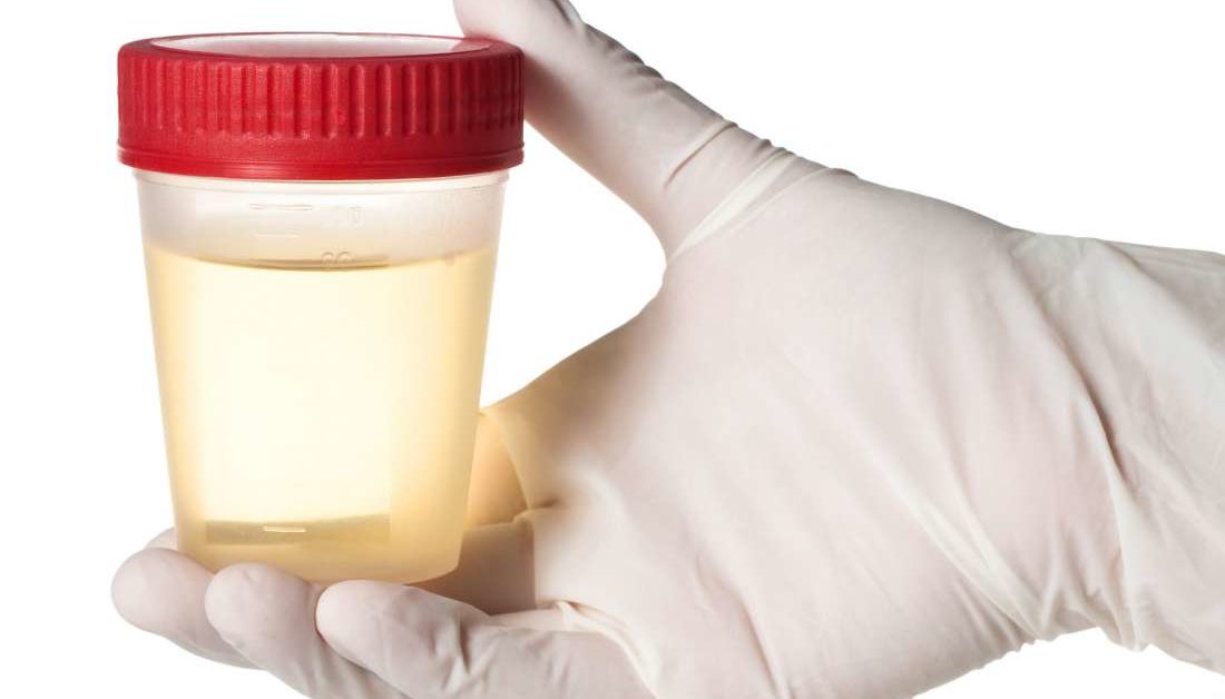 Urine Smells Like Ammonia Causes Treatments And Symptoms