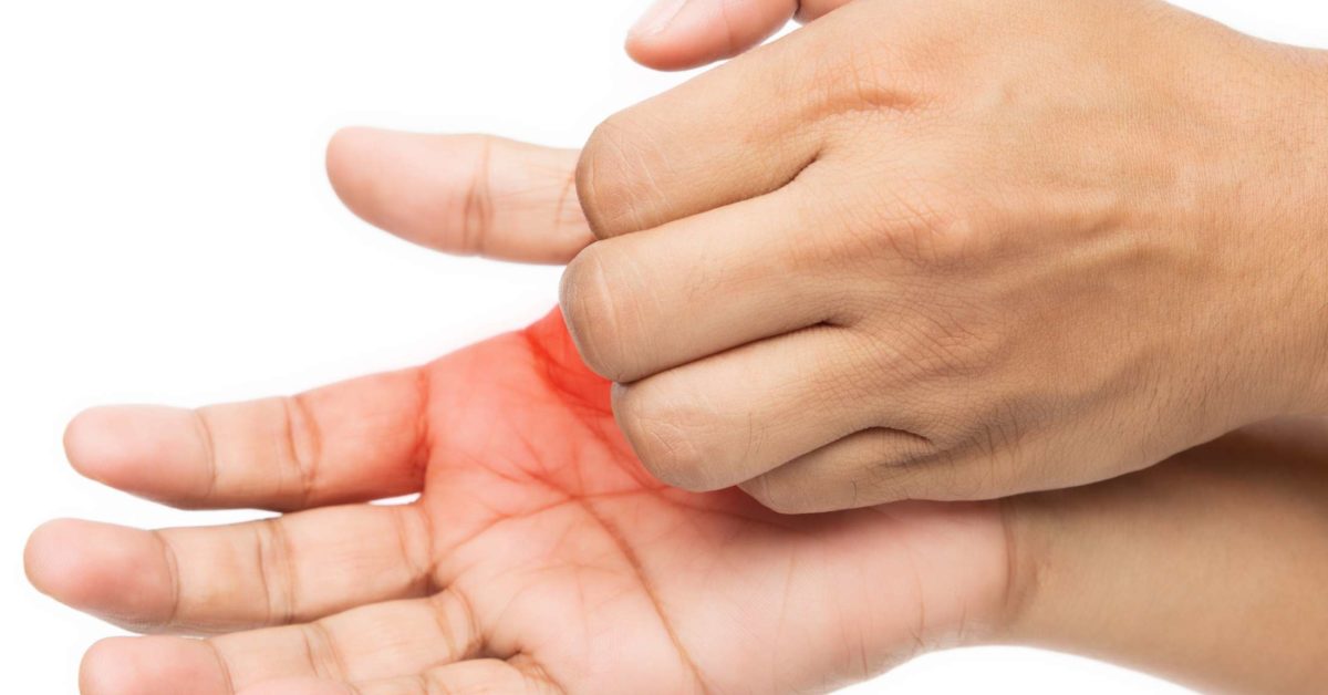 Itchy palms 6 causes, treatment, and prevention