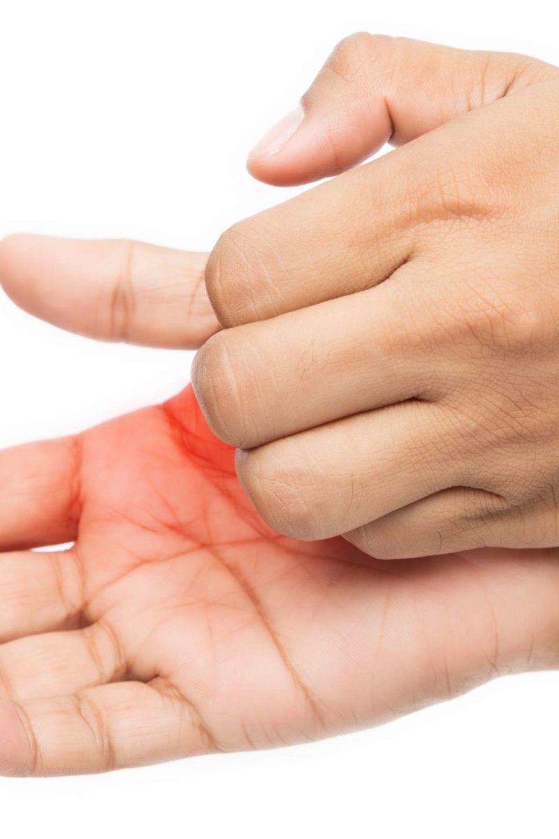 Itchy Palms 6 Causes Treatment And Prevention