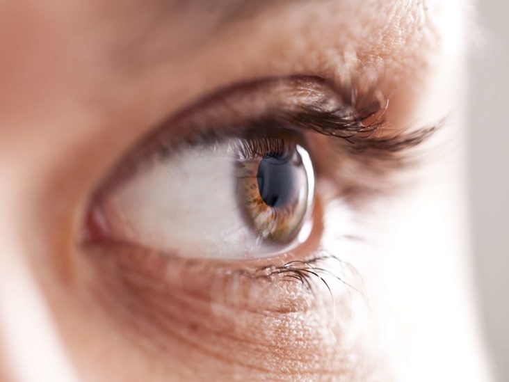 Broken Eye Socket Pictures Causes And Treatment