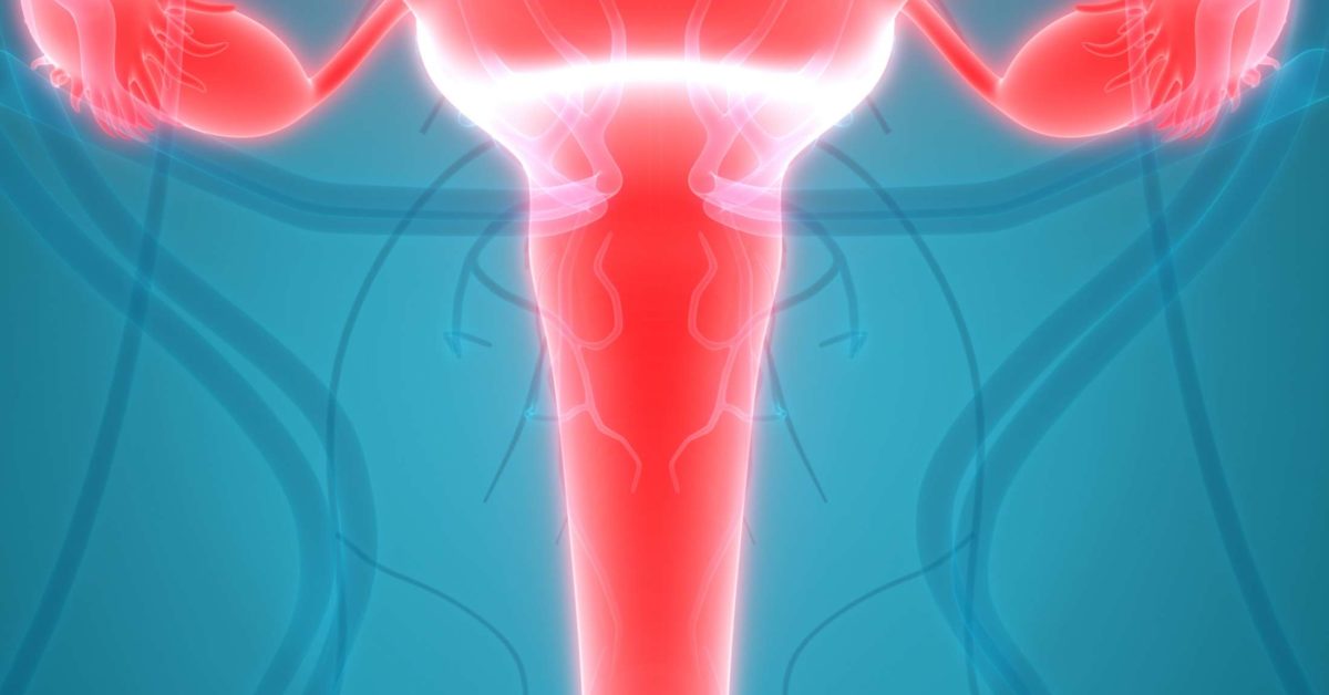 Cervicitis Symptoms, causes, treatments, and natural remedies